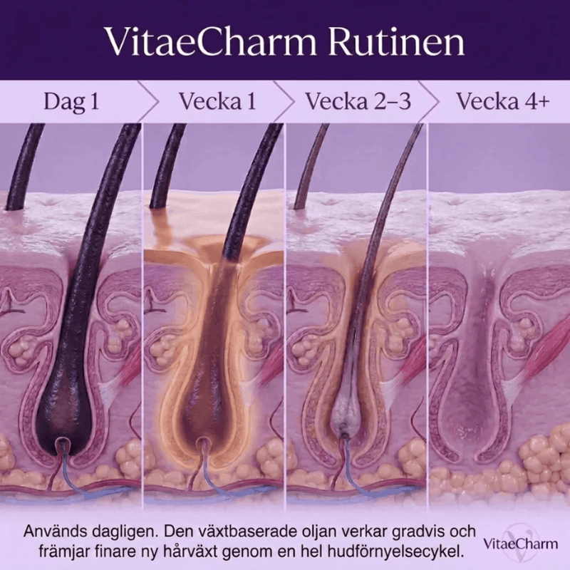 Vitae Charm Hair Reduction Serum